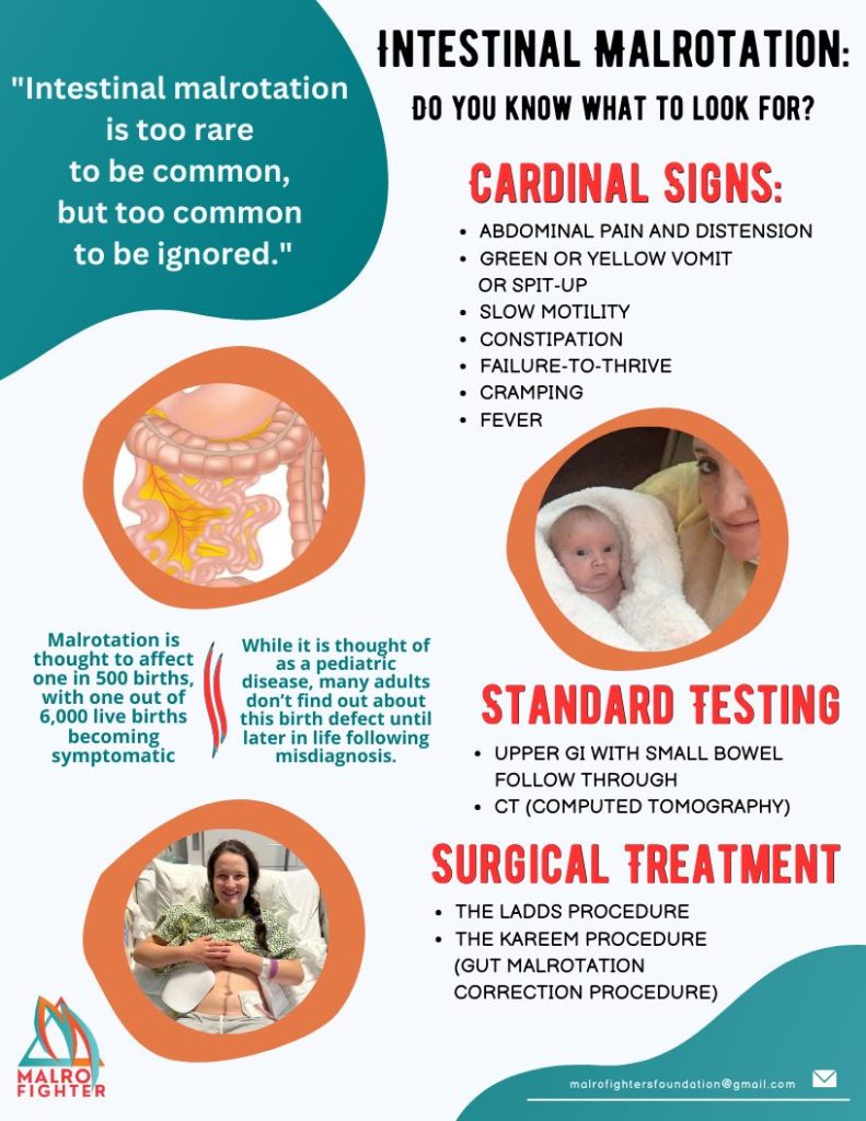 "Intestinal Malrotation" flyer with helpful information about malro common signs and testing.