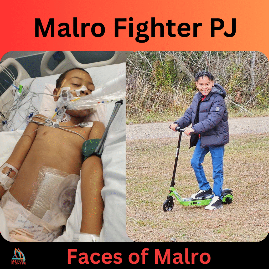 Malro Fighter PJ seen in the hospital with intestinal malrotation.